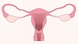 menapoz