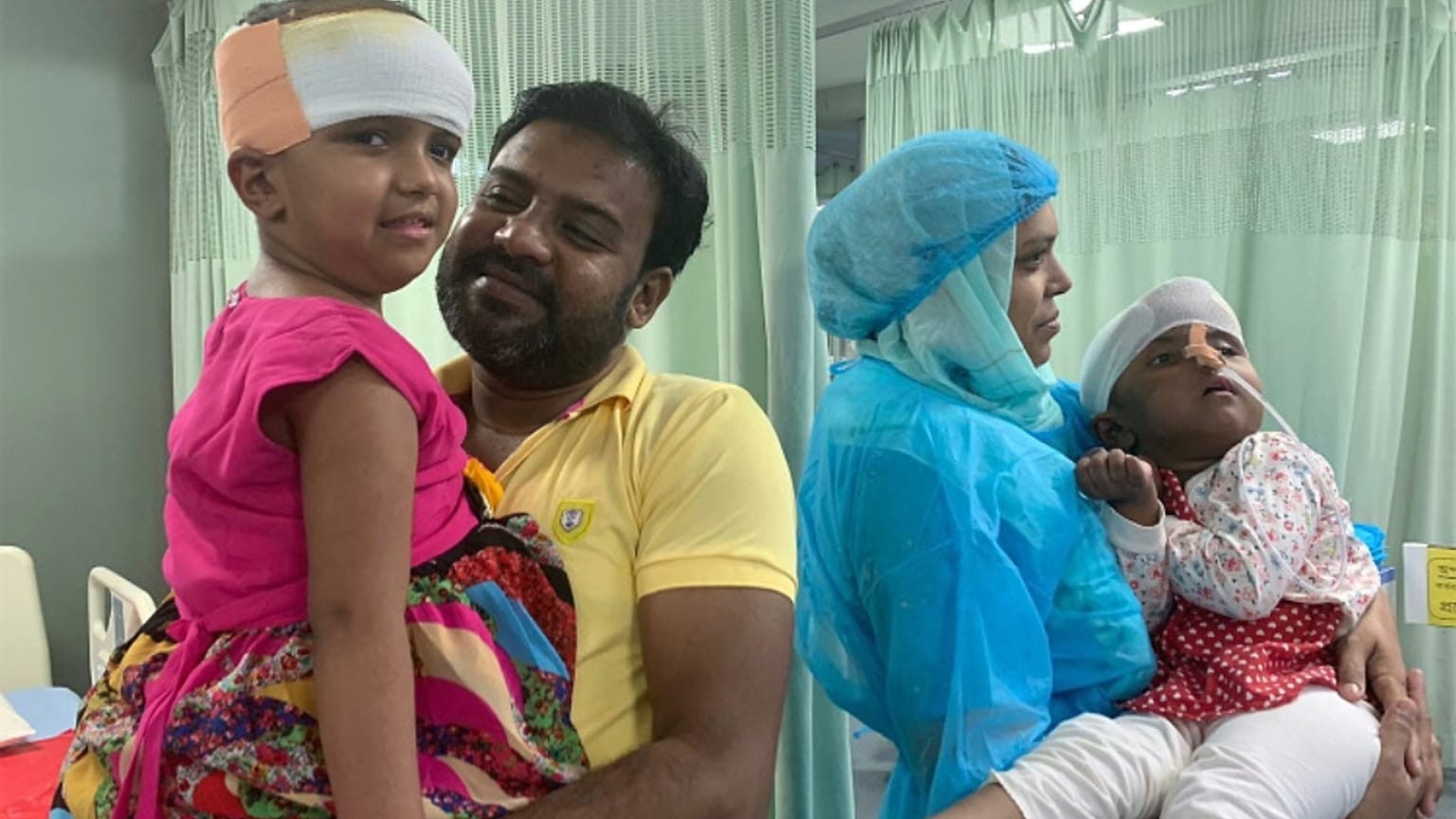 A bangladesi sziámi ikrek másik tagja is elhagyhatta az intenzív osztályt