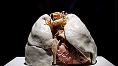 Nemdohányzó ember tüdőpreparátuma az emberi szervezet felépítését, működését bemutató Az emberi test (The Human Body) című kiállításon