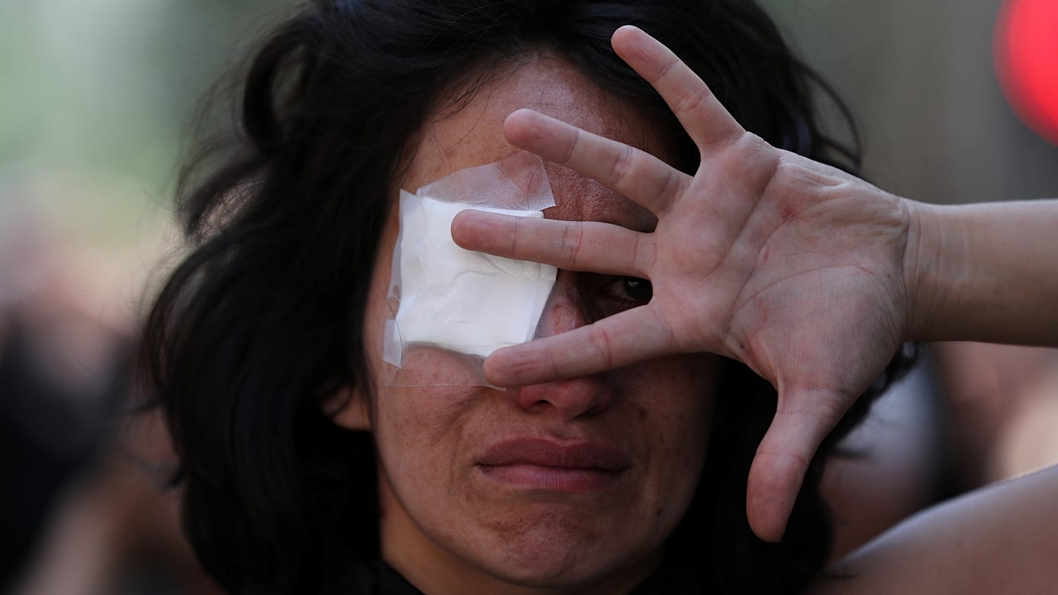 Une femme manifeste en soutien aux personnes ayant perdu un œil dans les manifestations. Santiago, Chili, le 12 novembre 2019