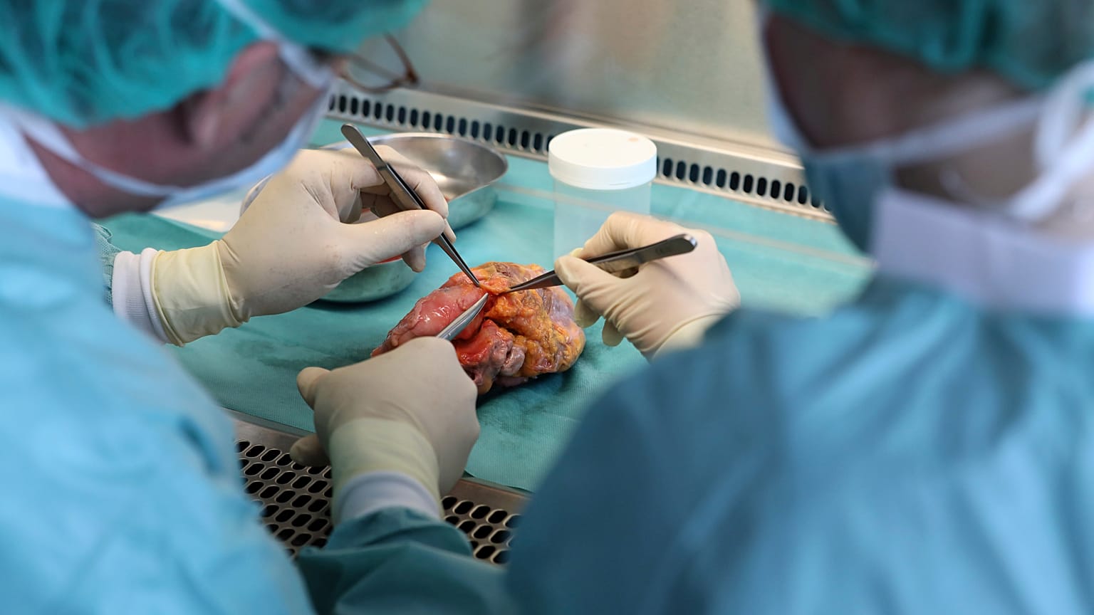 Almanya'da organ bağışı reform teklifi parlamentoda reddedildi