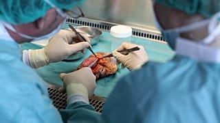 Organspende: Bundestag stimmt gegen Spahns Widerspruchslösung