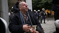 Ο δημοσιογράφος Τόμας Γιακόμπι τραυματισμένος από εθνικιστές με κουκούλες που συμμετείχαν σε διαδήλωση κατά των μεταναστών στο Σύνταγμα