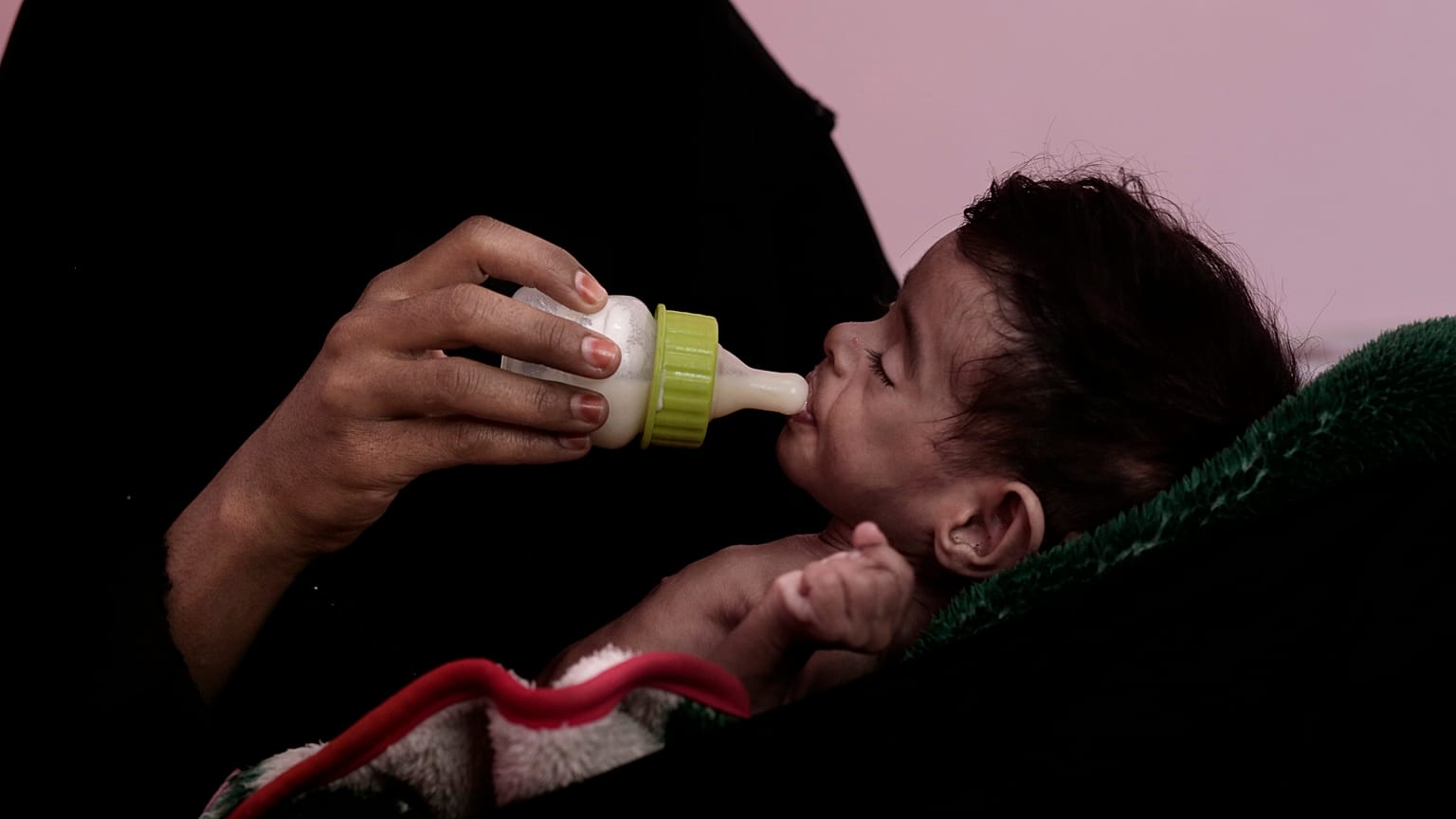 أم ترضع طفلها البالغ من العمر سبعة أشهر والذي يعاني من سوء التغذية 