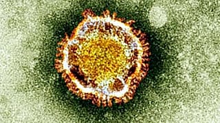 Illustration : le syndrome respiratoire du Moyen-Orient (MERS) vu au microscope, photographié en 2013. Le coronavirus 2019-nCov est de la famille du MERS.