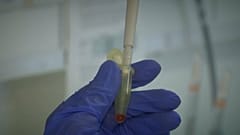 Neuartiger Coronavirus: Was jetzt zu tun ist 