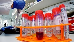 Römische Wissenschaftler isolieren Coronavirus 2019-nCoV 