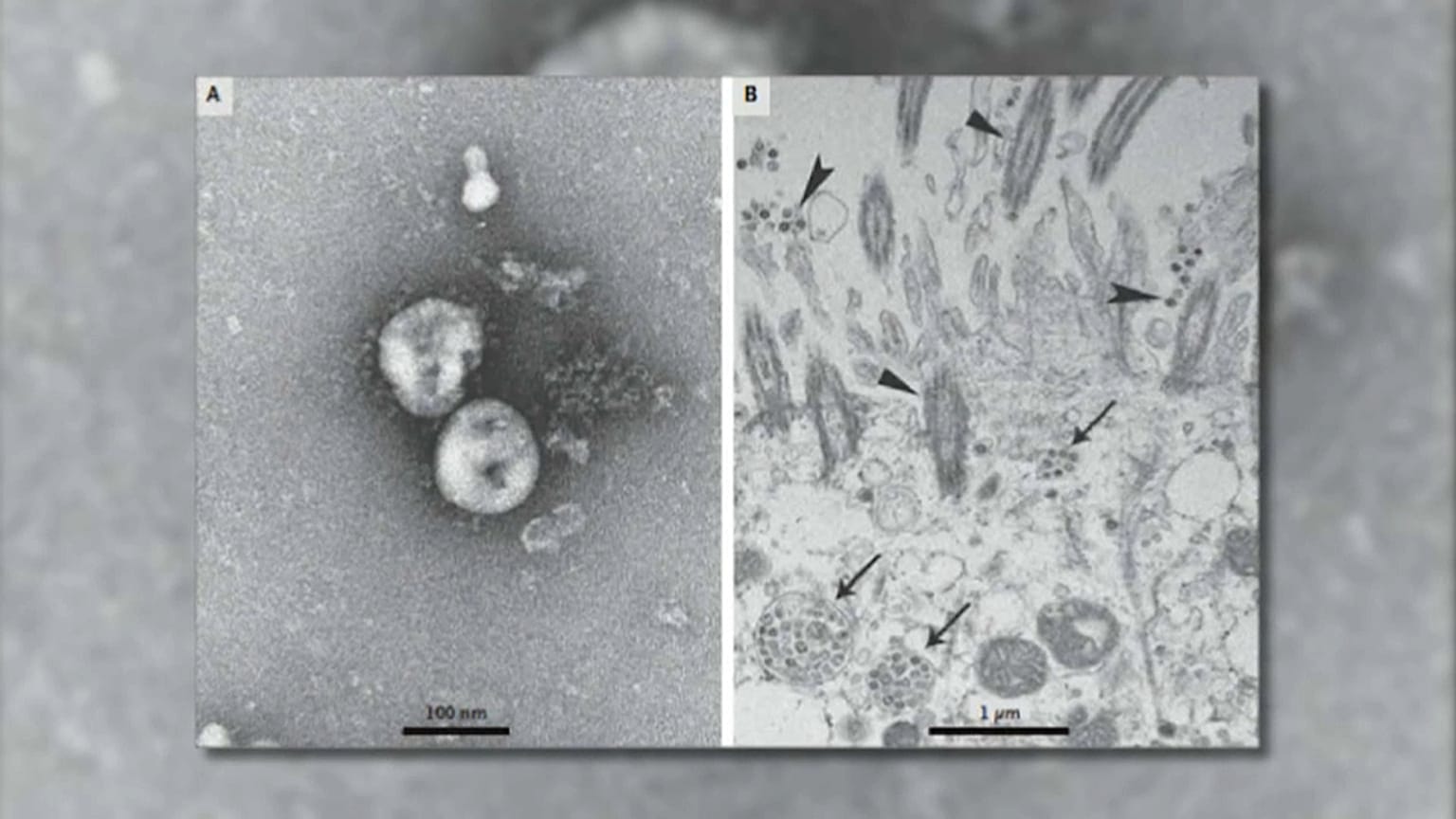 Coronavirus : une course contre la montre scientifique