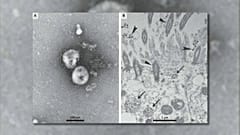 Coronavirus : une course contre la montre scientifique