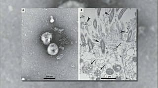 Coronavirus : une course contre la montre scientifique