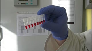 Vírusminták a Nemzeti Népegészségügyi Központ laborjában