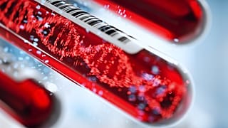 test tüpleri