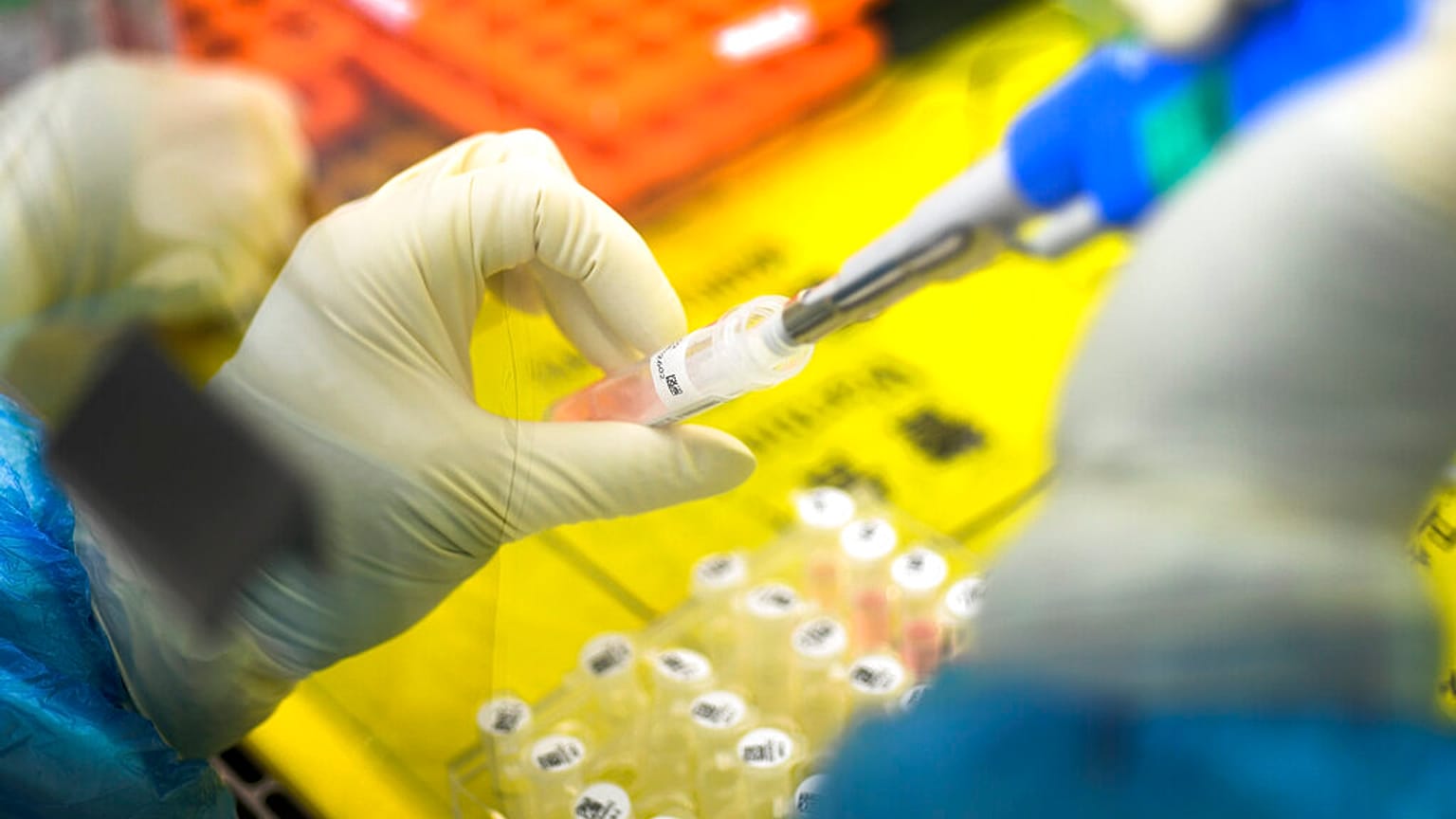 An employee works in the pop-up Huoyan Laboratory speciallized in the nucleic acid test on 2019-nCoV 
