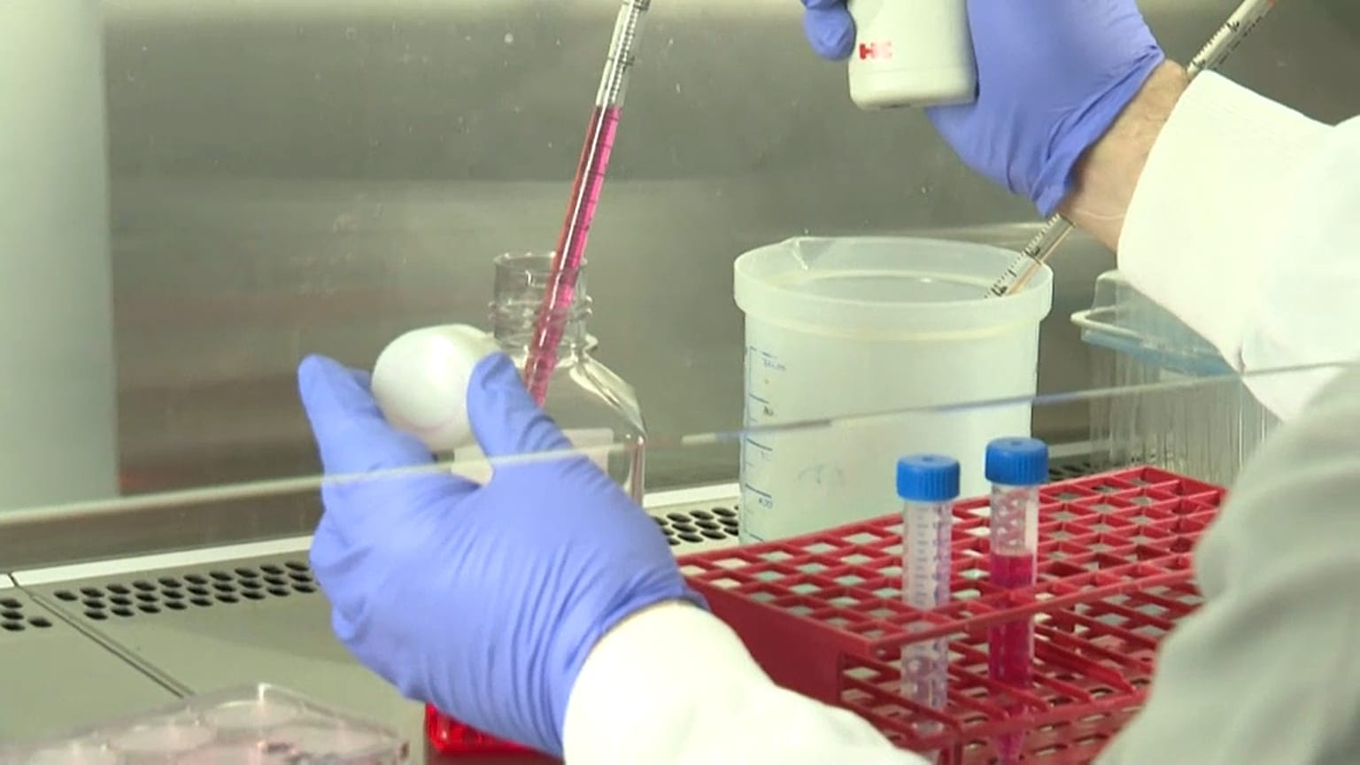Coronavirus: Das Rennen um den Impfstoff
