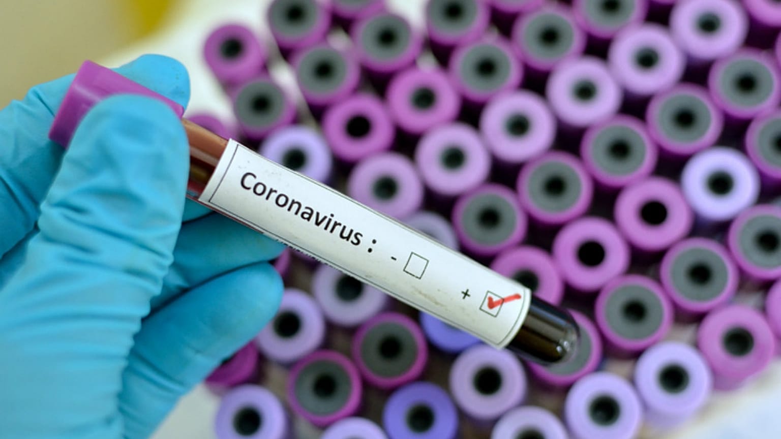 Advanced Sterilization Products on Preventing the Spread of Coronavirus from Contaminated Medical Devices