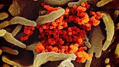 Le coronavirus SARS-CoV-2 responsable de l'épidémie de Covid-19 vu au microscope électronique et échantillonné par un laboratoire américain de recherche sur les allergies.