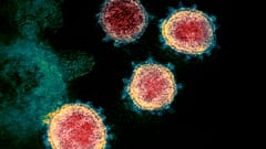 This undated electron microscope image made available by the U.S. National Institutes of Health in February 2020 shows the Novel Coronavirus SARS-CoV-2. 