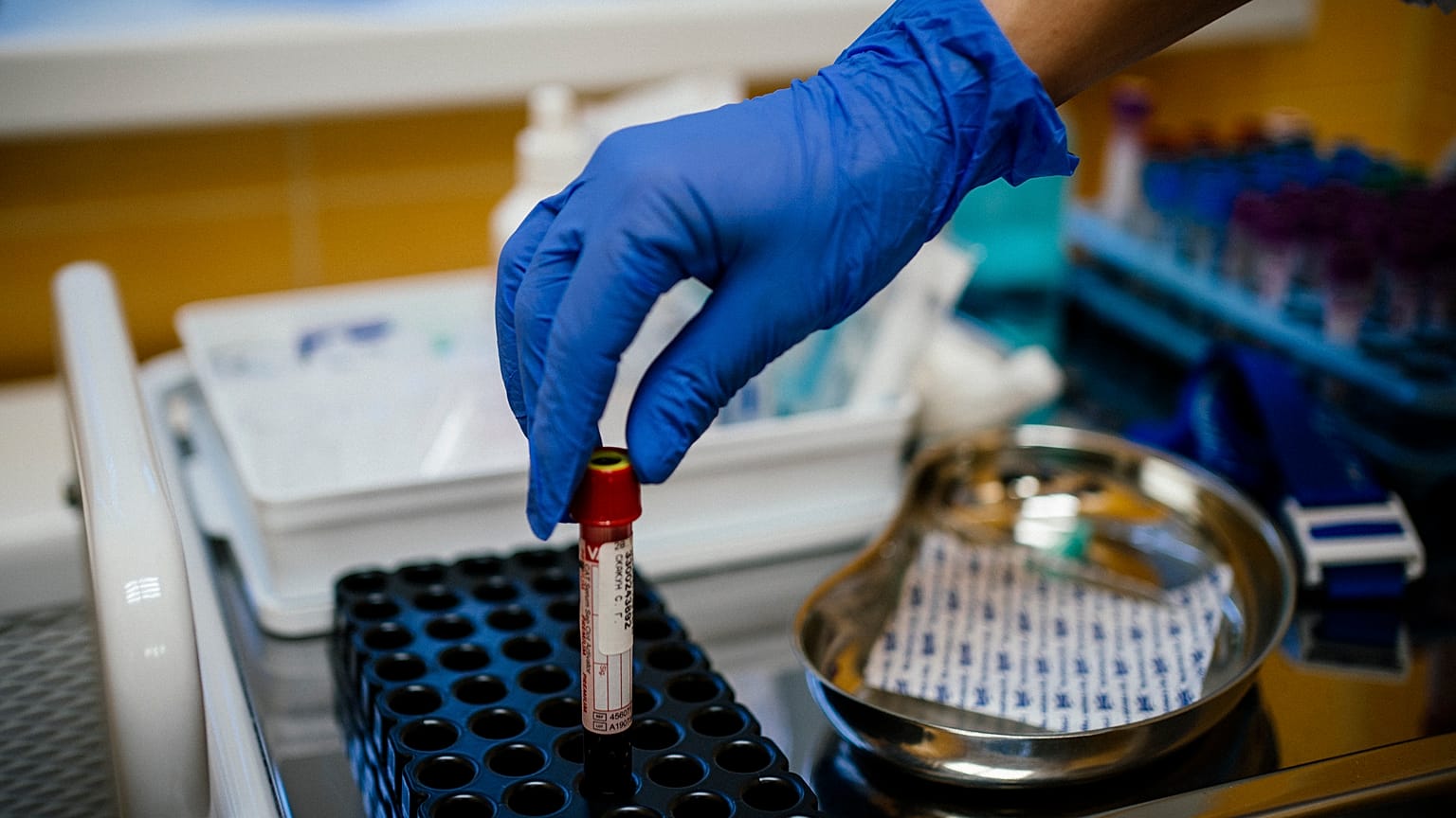 Orosz biohekkerek keresik az örök élet titkát