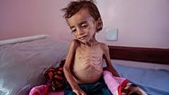الحوثيون عرقلوا وصول نصف المساعدات الغذائية التي قدمتها الأمم المتحدة لليمن