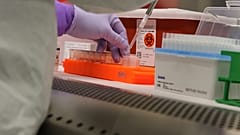 Coronavirus: Über 500 Infizierte in Deutschland