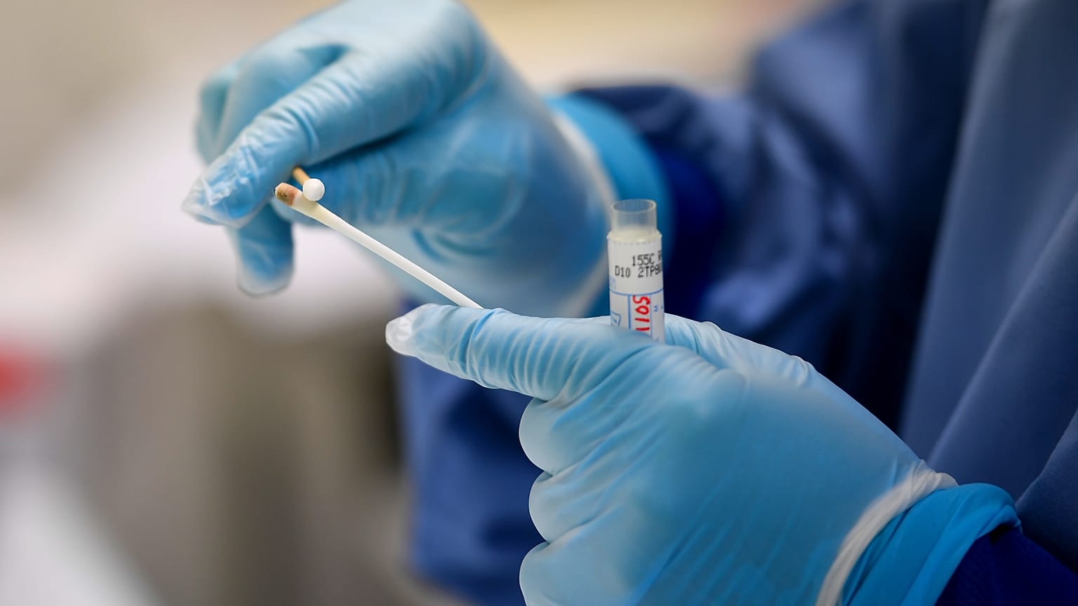 Vò Euganeo, laboratorio mondiale del coronavirus. Secondo tampone per tutti