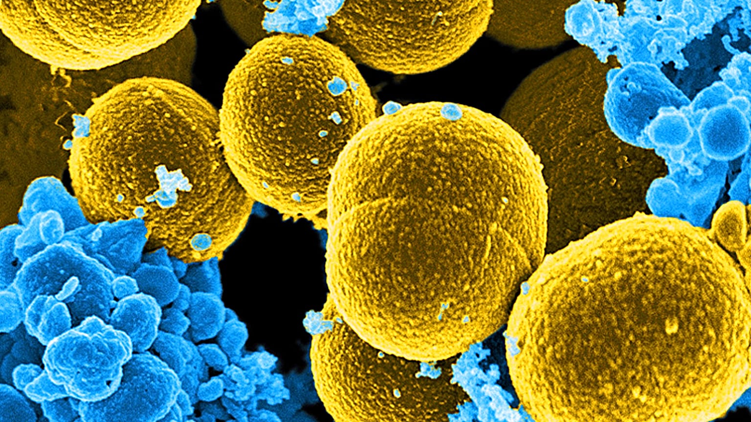 Skin Bactreria