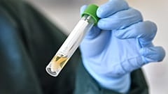 Eine Krankenschwester demonstriert die Entnahme einer Probe für einen Coronavirustest auf der Infektionsstation des Universitätsklinikums in Essen, Deutschland