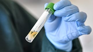 Eine Krankenschwester demonstriert die Entnahme einer Probe für einen Coronavirustest auf der Infektionsstation des Universitätsklinikums in Essen, Deutschland