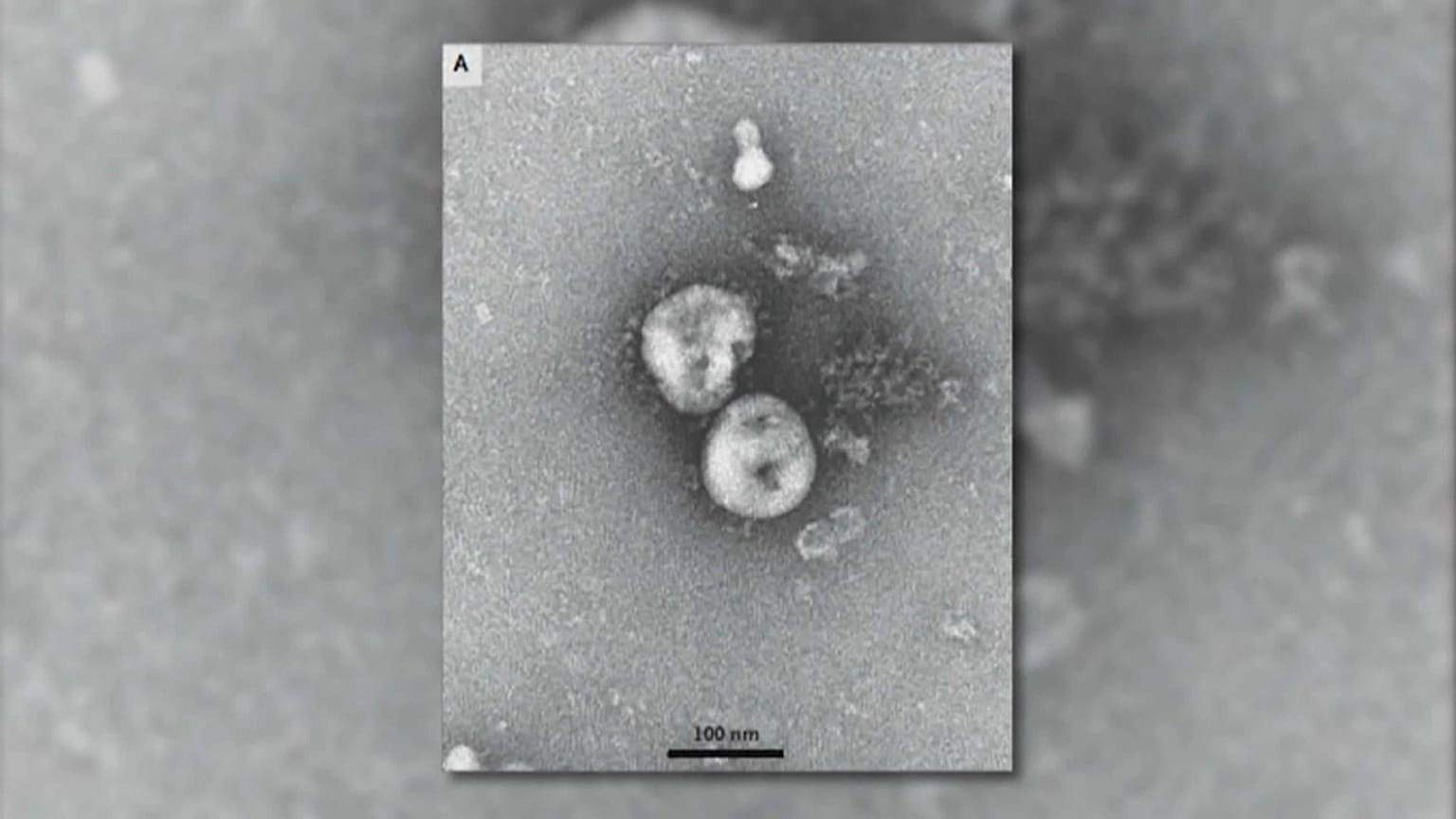 Belgio:  dall'organismo dei Lama, un anticorpo contro il coronavirus
