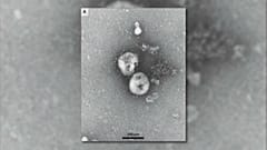 Belgische Forscher haben einen ANtikörper zu Covid-19 entdeckt
