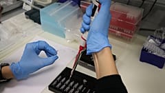  kan testi
