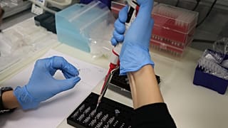 kan testi