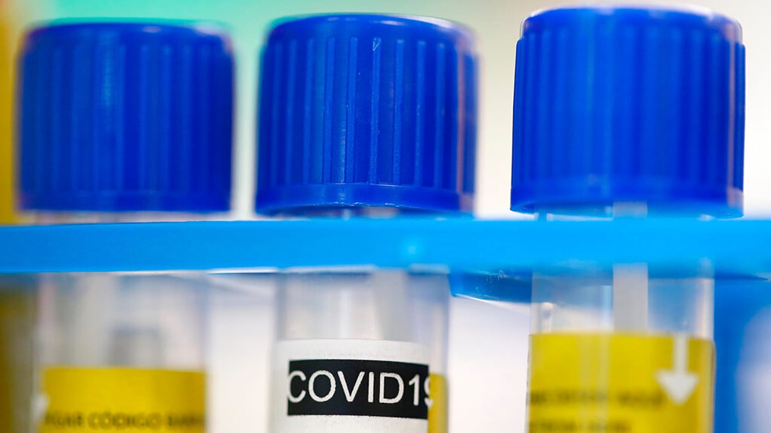 COVID-19: kilencre emelkedett a magyar áldozatok száma