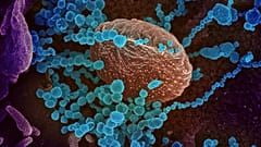 El nuevo coronavirus (en azul) surge de células cultivadas en laboratorio. El virus obtenido de un paciente estadounidense.