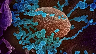 El nuevo coronavirus (en azul) surge de células cultivadas en laboratorio. El virus obtenido de un paciente estadounidense.