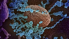 Coronavirus: tra certezze (poche) e bufale (tante), quello che sappiamo sul Sars-Cov2