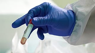 Γρίπη και COVID-19: Πού μοιάζουν, πού διαφέρουν