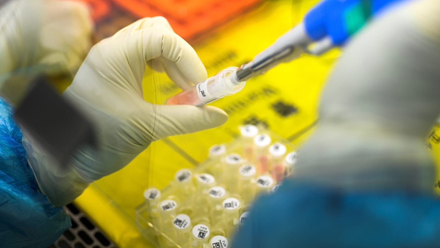 Avrupa'ya sattığı Covid-19 test kitleri hatalı sonuç veren Çin ihraç için lisans şartı koydu