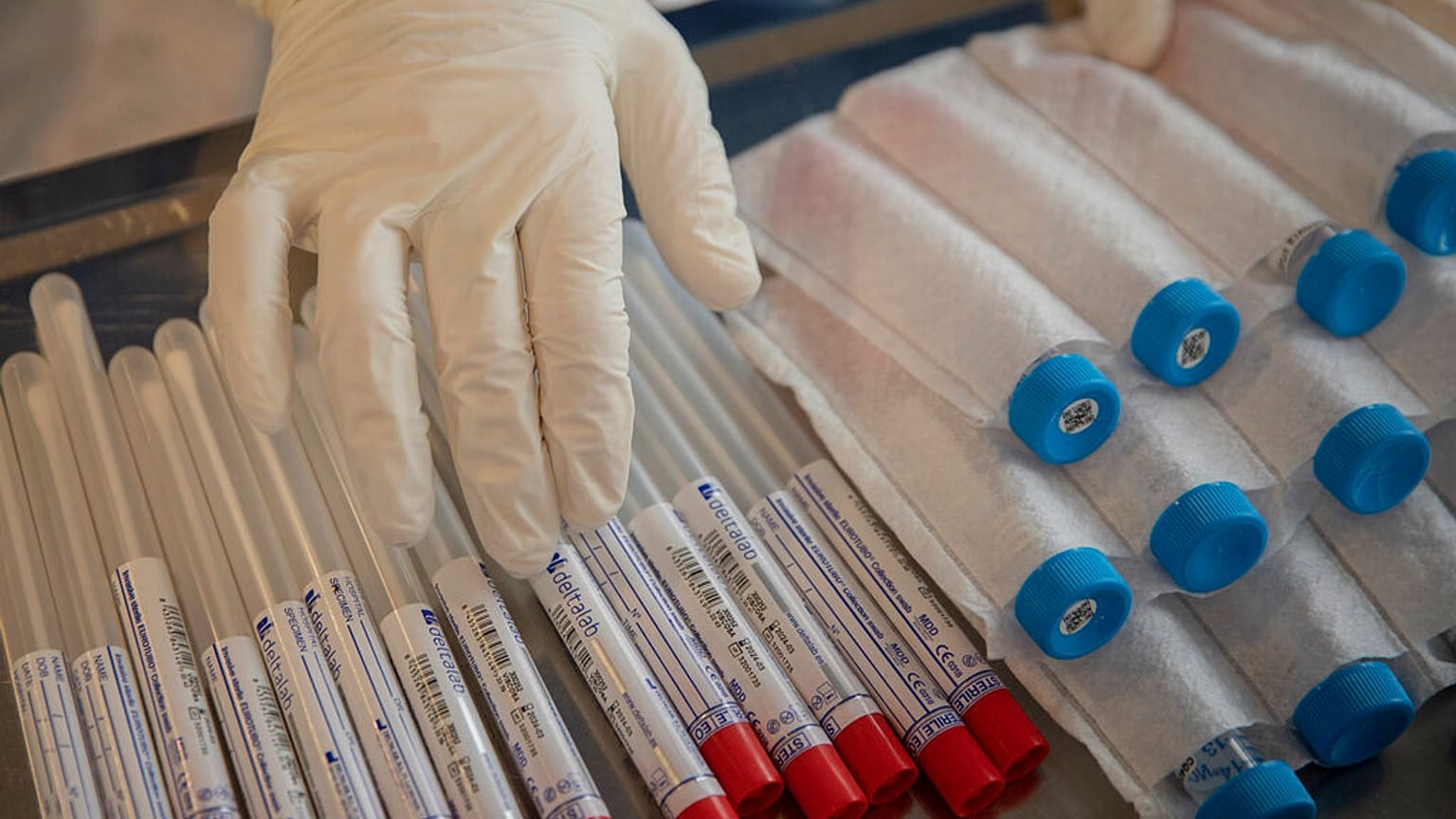 Virus Outbreak Spain
