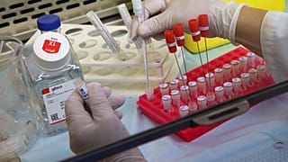 ΙΝΣΤΙΤΟΥΤΟ ΝΕΥΡΟΛΟΓΙΑΣ ΚΑΙ ΓΕΝΕΤΙΚΗΣ - Ο ΚΟΡΩΝΟΪΟΣ ΣΤΟ ΜΙΚΡΟΣΚΟΠΙΟ