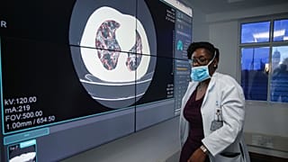 Un médecin devant un écran montrant un exemple de scanner des poumons d'un patient atteint de coronavirus, au Kenyatta National Hospital à Nairobi, Kenya Jeudi 2 avril 2020