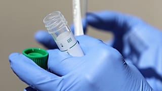 Negyedórás francia teszt a vírus kimutatására