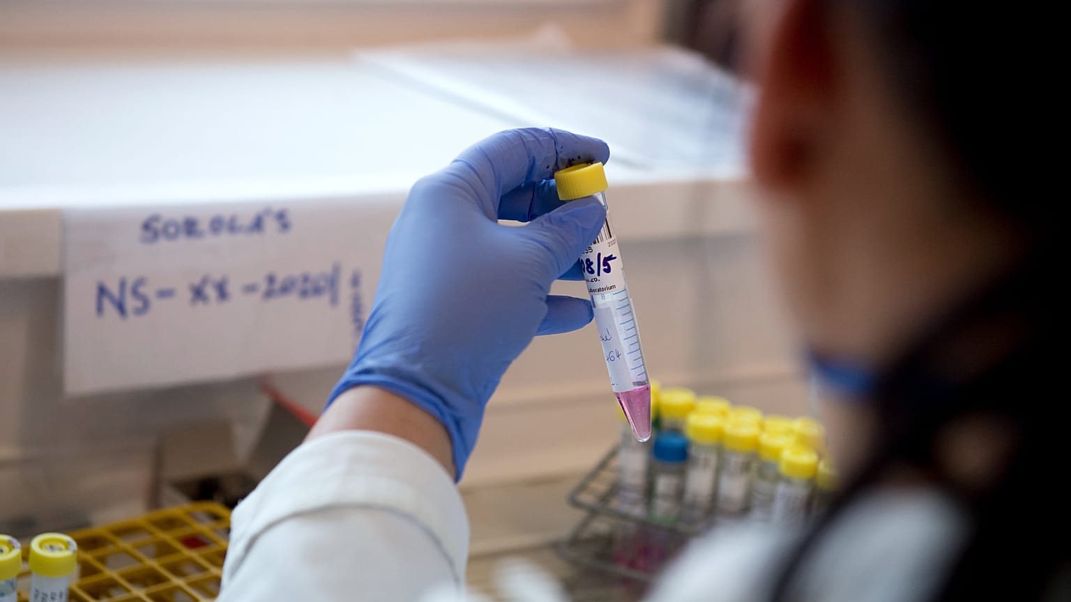Koronavírus - A Nemzeti Népegészségügyi Központ Virológiai Laboratóriuma