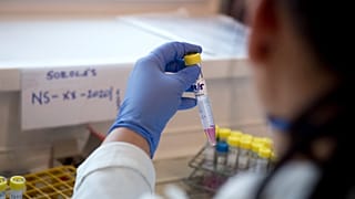 Koronavírus - A Nemzeti Népegészségügyi Központ Virológiai Laboratóriuma