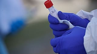 Araştırma: Resmi veriler gerçek Covid-19 vaka sayısının sadece yüzde 6'sını yansıtıyor