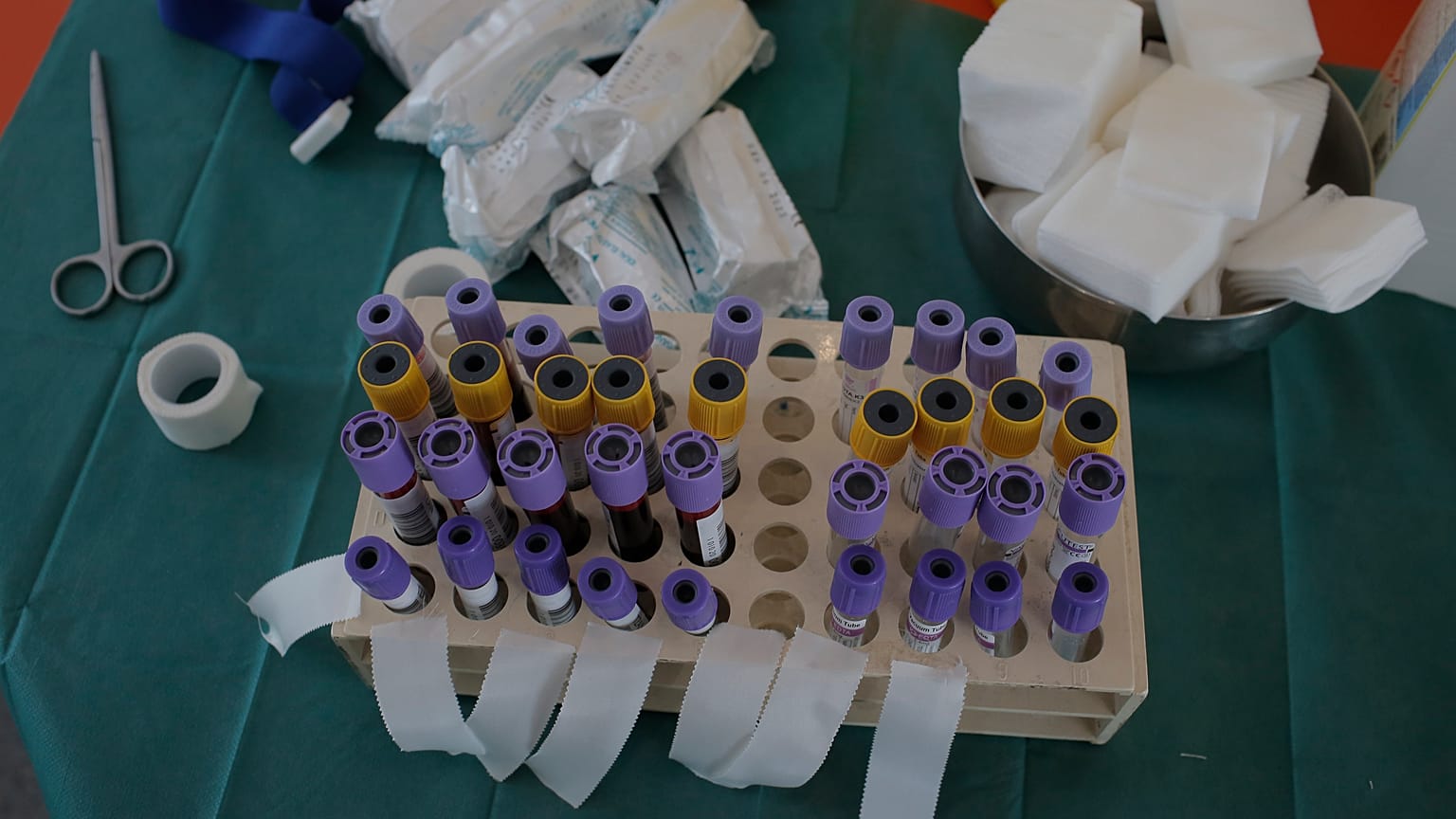 Ελλάδα: Δύο θάνατοι και 36 νέα κρούσματα COVID-19 εκ των οποίων τα 2 σε πύλες εισόδου