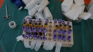 Ελλάδα: Δύο θάνατοι και 36 νέα κρούσματα COVID-19 εκ των οποίων τα 2 σε πύλες εισόδου