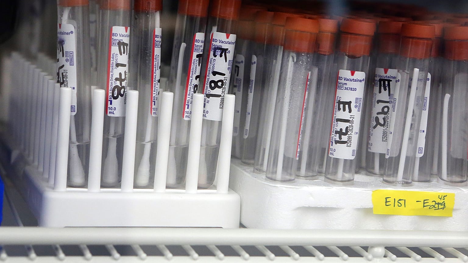 Virus Outbreak Texas/ FILE PHOTO