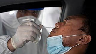 معظم المصابين بكورونا فقدوا حاسة التذوق أو الشم