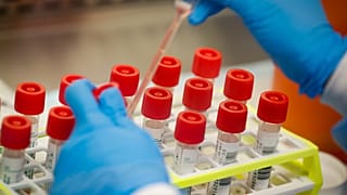 A technician prepares COVID-19 coronavirus patient samples for testing at a laboratory in New York's Long Island. 